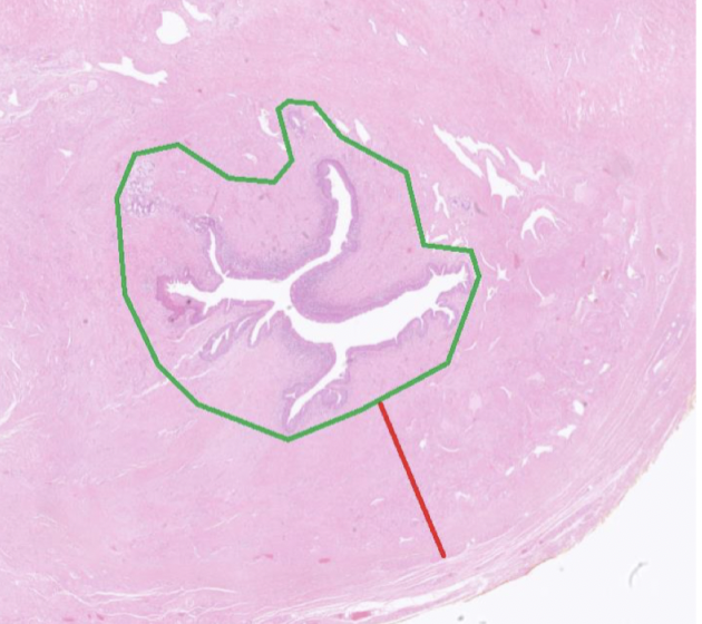 <p>Urethra har pseudostratifierat kolumnärt epitel proximalt och skivepitel i distalt. Här finns även periurethrala körtlar. </p><p>Röd: Corpus spongiosum</p><p>Grön: Mucosa för urethra. </p>