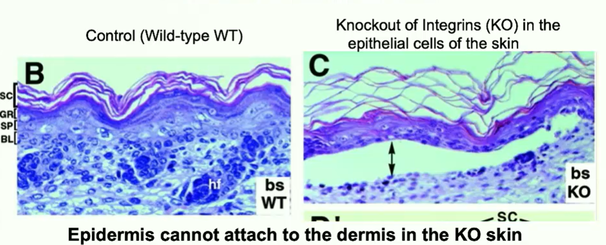 <p>Anchor epithelial cells to the basement membrane in the ECM </p>