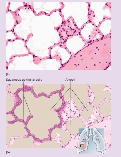 <p>single layer of thin cells, shaped like fried eggs with a bulge where the nucleus is located; nucleus somewhat flattened in the plane of the cell, like an egg yolk; cytoplasm may be so thin it is hard to see in tissue sections; in surface view, cells have angular contours and nuclei appear</p>