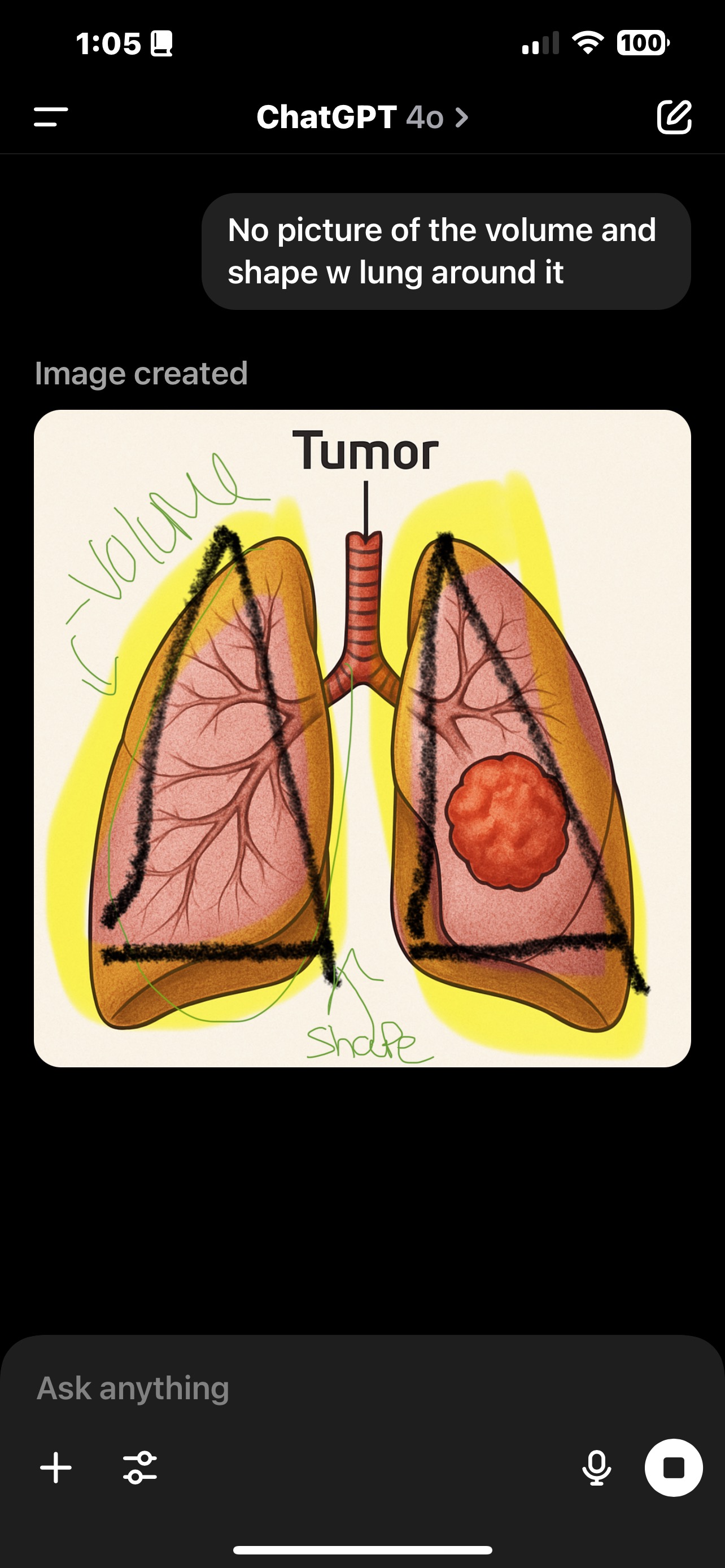 <p><span>• Radiation therapy is localized → Focuses on a specific area.</span></p><p><span>• Target details → Location, volume, and shape of the tumor.</span></p><p><span>• Secondary targets → Any nearby areas that also need treatment.</span></p><p><span>• Critical structures → Important organs/tissues to protect.</span></p><p><span>• Radiobiology → How radiation affects tumor and normal tissues.</span></p><p><span>• Dose AND volume → Amount of radiation needed for both tumor and normal structures.</span></p>