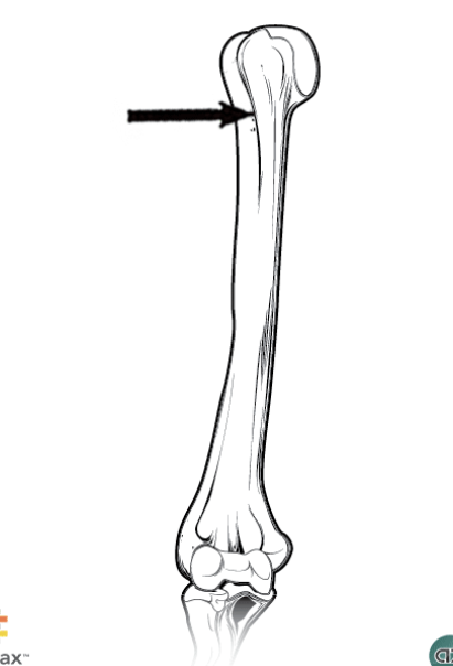 <p>Humerus </p>