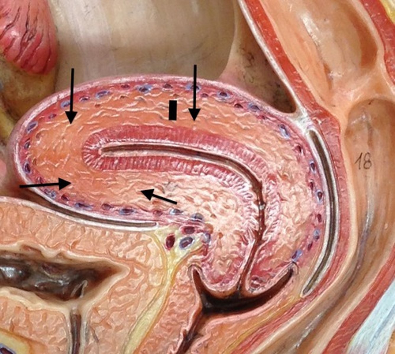 <p>Name this layer of the uterus</p>
