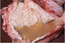 <p>severe cranioventral pneumonia, fibrin on pleura, pleuritis </p>