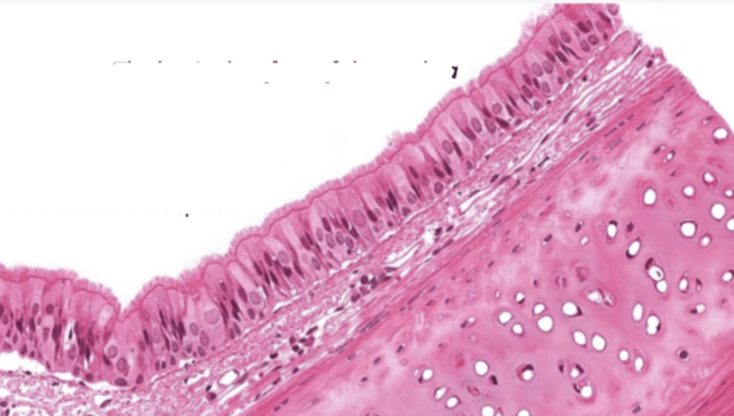 <p>Identify the type of epithelia</p>