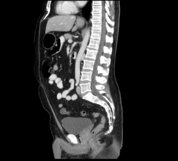 <p>Which CT view?</p>