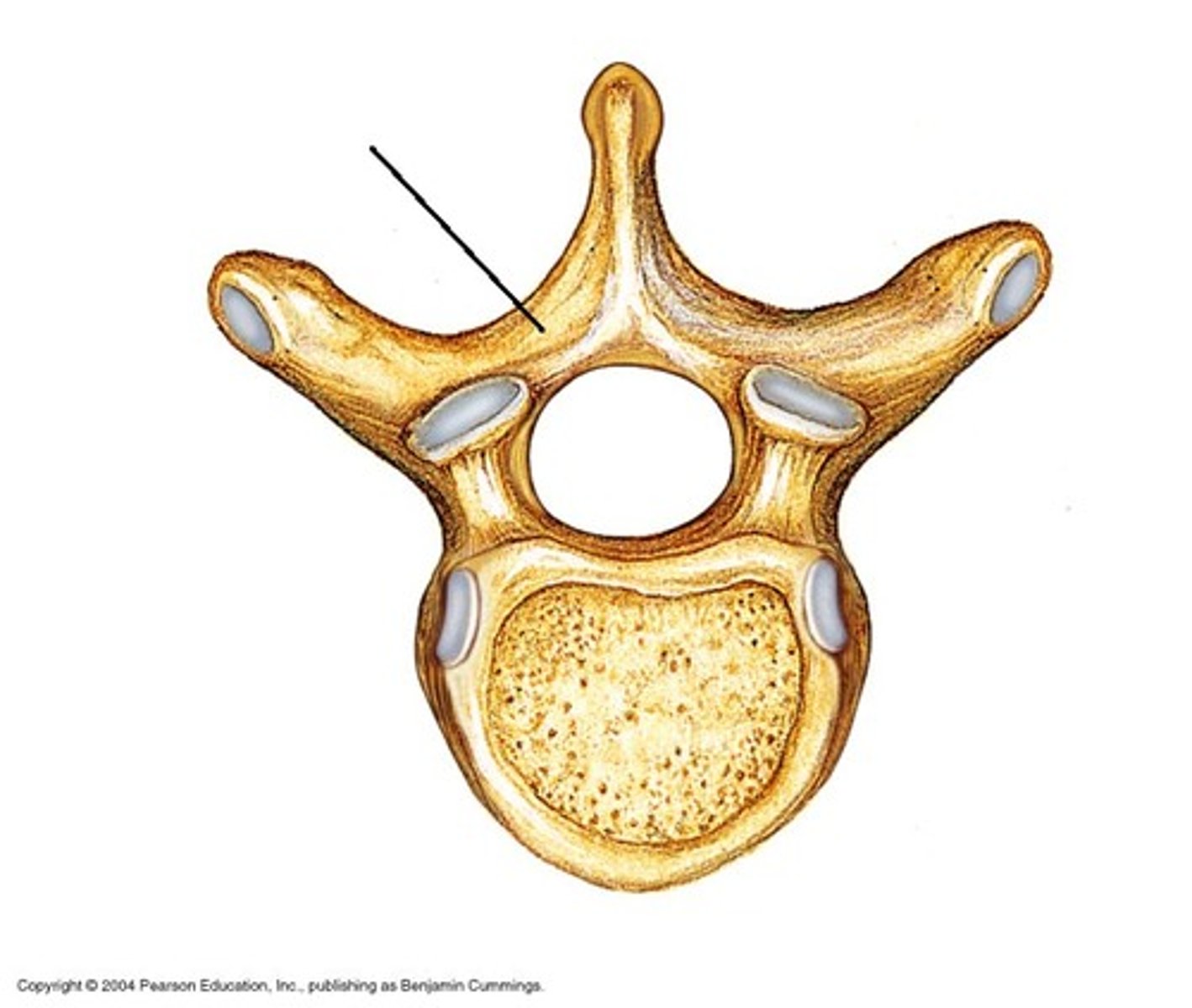 <p>helps form the vertebral arch; towards the spinous process</p>