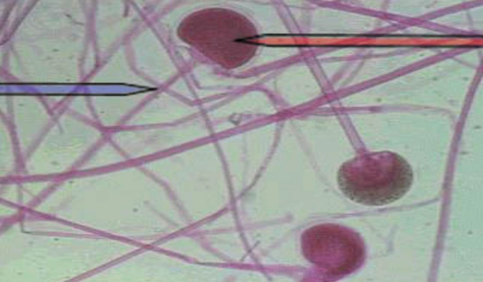 <p><em>Rhizopus</em> — </p><p>What is it’s spore structure name?</p>