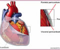 <p>portion of pericardium close to the chest wall</p>