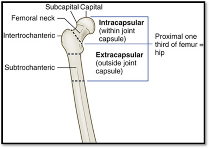 <p><strong><span>Hip Fracture </span>( Def. / S&amp;S / Comp. / Diagnostic / Tx / Nursing)</strong></p>