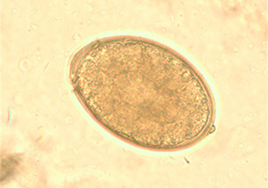 Host: dogs, cats, humans
Intermediate host: 1st aquatic crustacean 2nd fish
Location: small intestine
Transmission: ingestion of infective fish
Diagnosis: eggs on fecal float
Treatment: praziquantel
Zoonotic?: yes
Common name: broad fish tapeworm
Key fact: absorb vitamin 12 to such an extent that they produce anemia and intestinal obstruction
