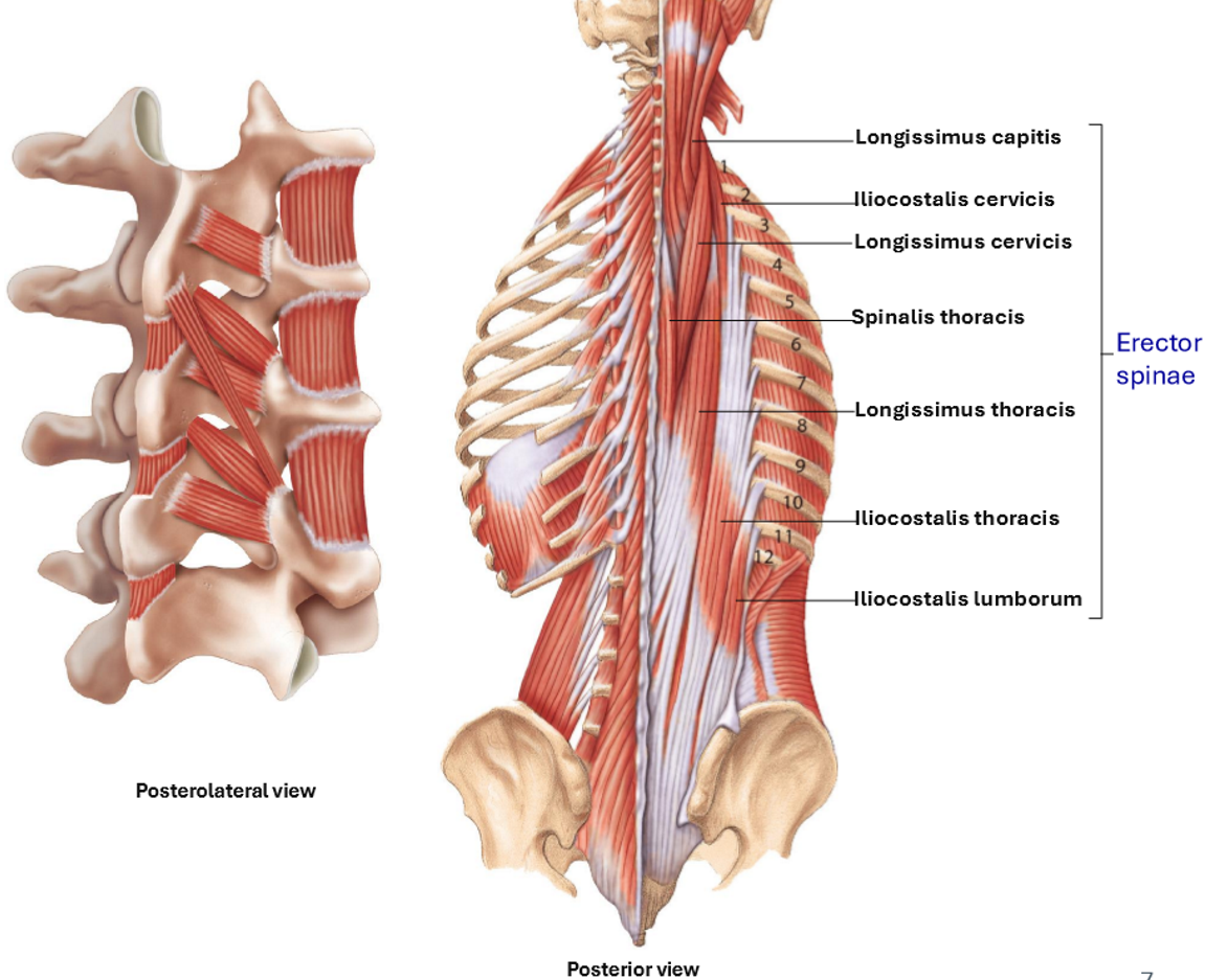 <p>Erector Spinae </p>