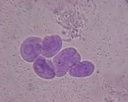 <ol start="47"><li><p>what does a Transitional epithelial cells look like?</p></li></ol><p>where are they derived?</p>
