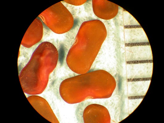 Sesbania herbacea
