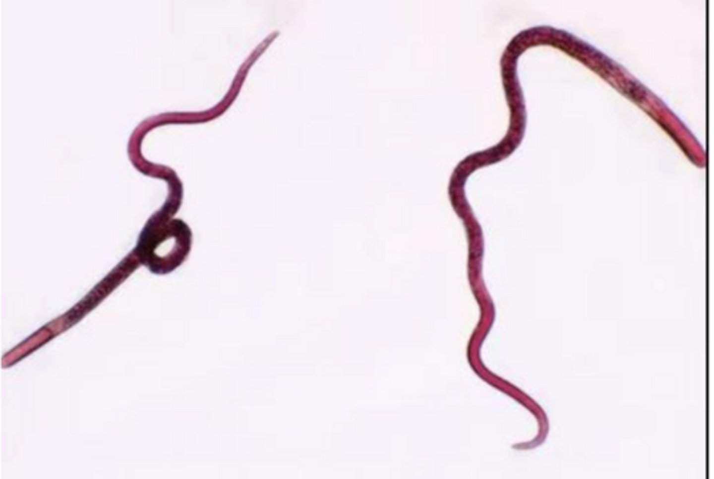 <p>trichinella - nematode</p>