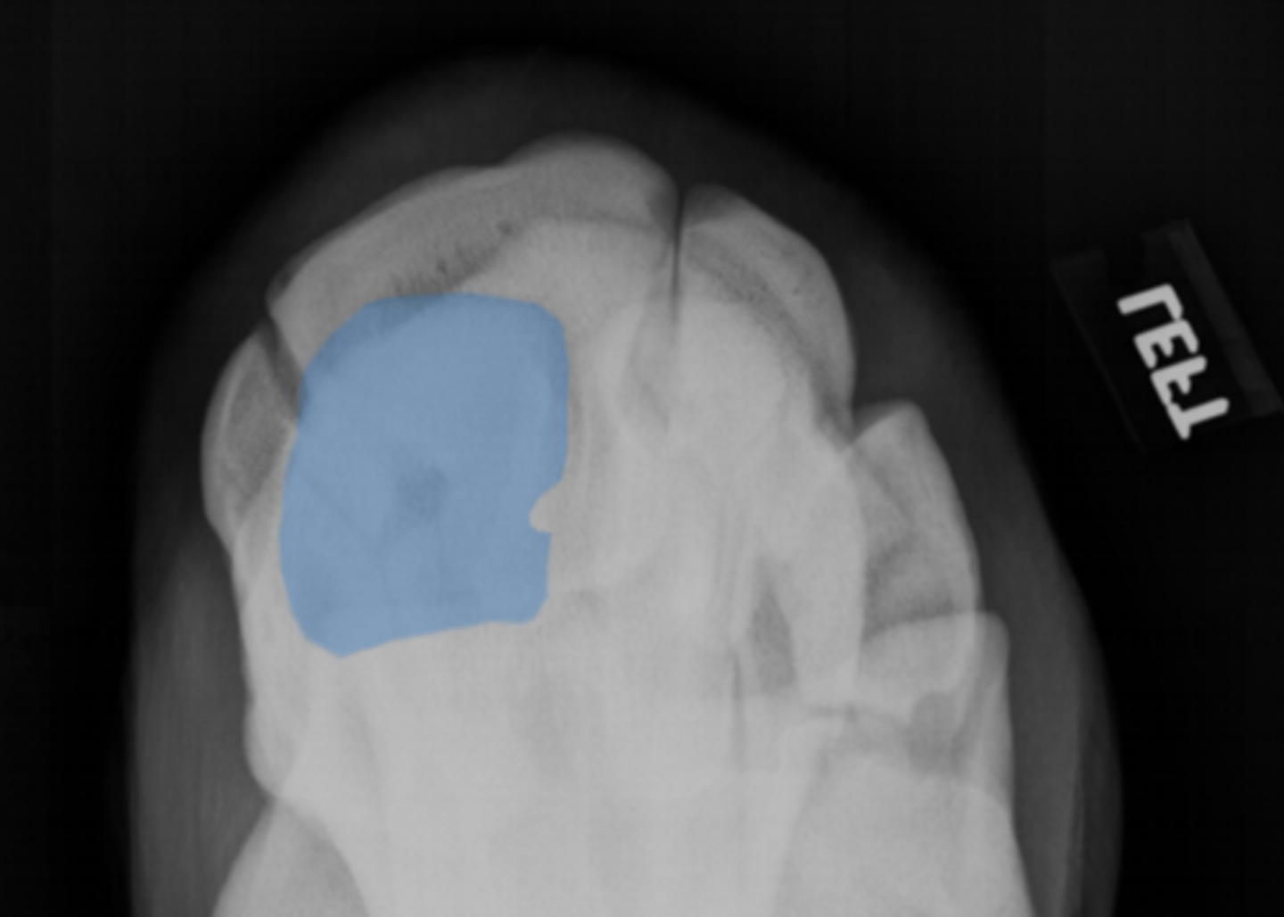 <p>What bone is highlighted?</p>
