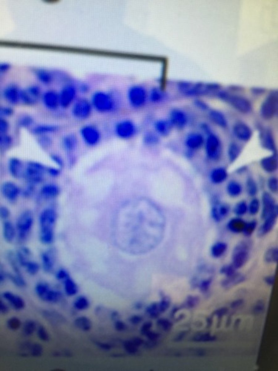 <p>The larger of the two haploid cells following meiosis I form this structure pictured above which is the start of Meiosis II</p>