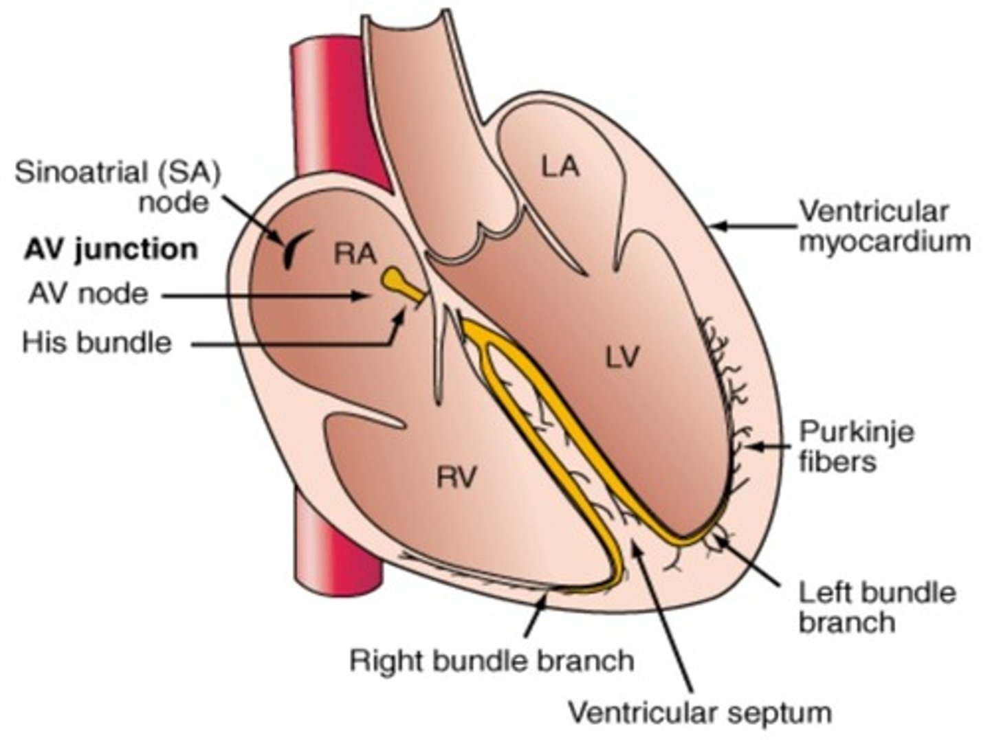 <p>1. Electrical activity is initiated at the sinoatrial (SA) node</p><p>­- Spontaneously generates action potentials</p><p>2. Wave of depolarization spreads through the atria</p><p>­- Atrial contraction occurs</p><p>3. Current reaches atrioventricular (AV) node</p><p>­- AV node slows conduction</p><p>- Ensures atrial contraction is completed before ventricles are activated</p><p>4. Continues down through Bundle of His (AV bundle)</p><p>­- Splits into right and left bundle branches</p><p>5. Bundle branches further divide into Purkinje fibers</p><p>­- Spread through ventricular walls, resulting in ventricular contraction</p>
