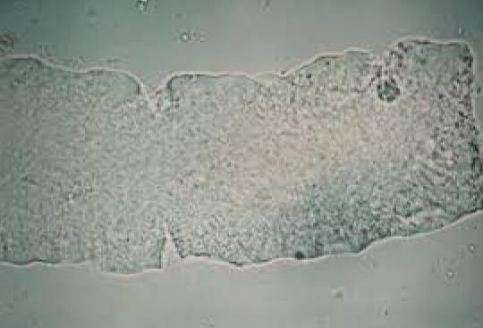 <p>What do you see in this image?</p><p>Is it clinically significant (normal or abnormal)?</p><p>What can it indicate?</p>