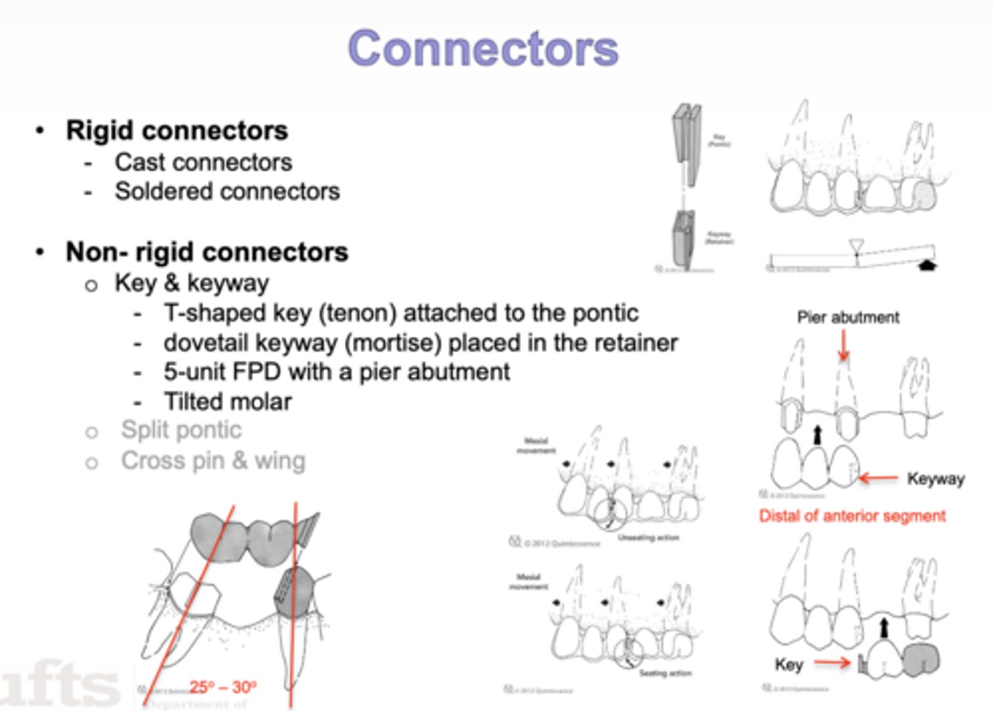 <p>- Key and keyway (connectors that are used to connect 2 FPD together)</p><p>- Split pontic</p><p>- Cross pin &amp; wing</p>