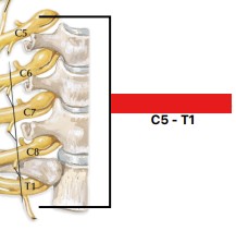 <p>Which plexus of the spinal nerves is:</p><ul><li><p>In shoulder and neck (C5 - T1)</p></li><li><p>Innervates upper limbs and pectoral girdle</p></li></ul><p></p>