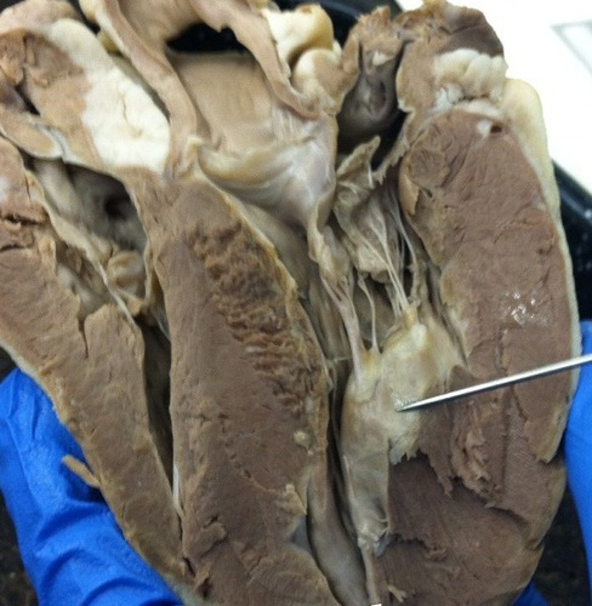 <p>Nipple-like which chordae tendineae is anchor to.</p>
