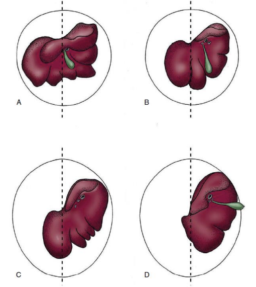 <p>it is the largest gland in the abdominal cavity, caudal to the diaphragm</p><p></p><p>bulk lies to the right in all species and in ruminants entirely moved to the right</p><p></p><p>gall bladder between the right medial and quadrate lobe</p><p></p><p>some species have no gallbladder in the fossa (horses, rats)</p><p></p><p>A=dog</p><p>D=ruminant</p>