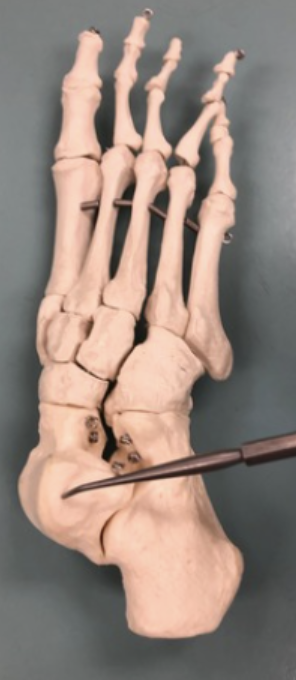 <p><span style="font-family: -apple-system, system-ui, Segoe UI, Roboto, Helvetica Neue, Arial, Noto Sans, Liberation Sans, sans-serif, Apple Color Emoji, Segoe UI Emoji, Segoe UI Symbol, Noto Color Emoji">Identify this bone.</span></p>