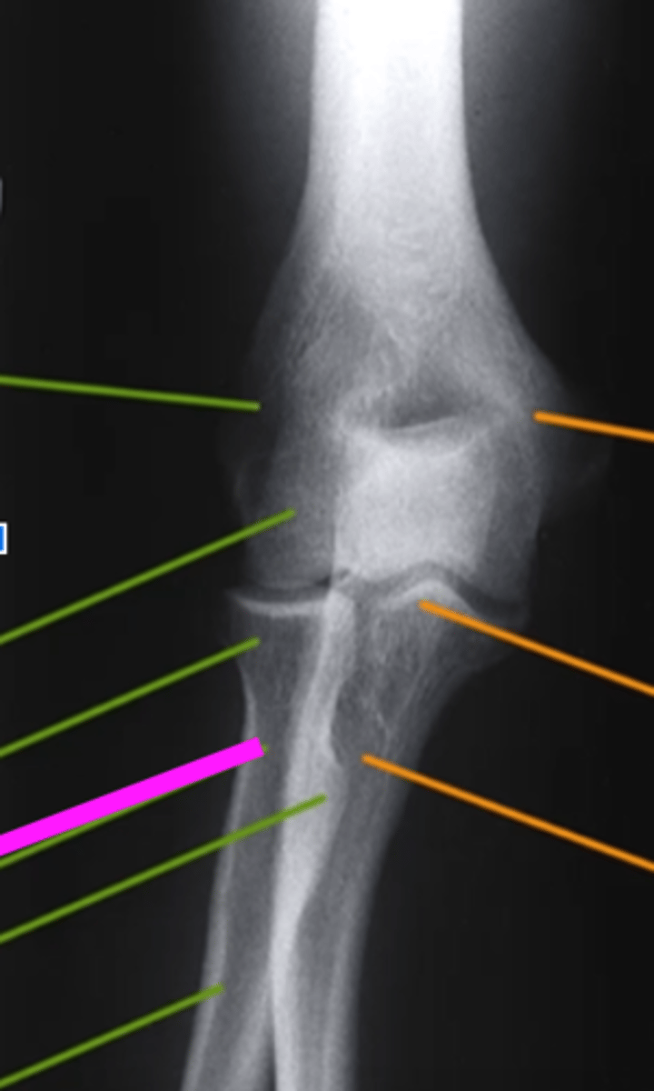 <p>what does the pink line point to?</p>