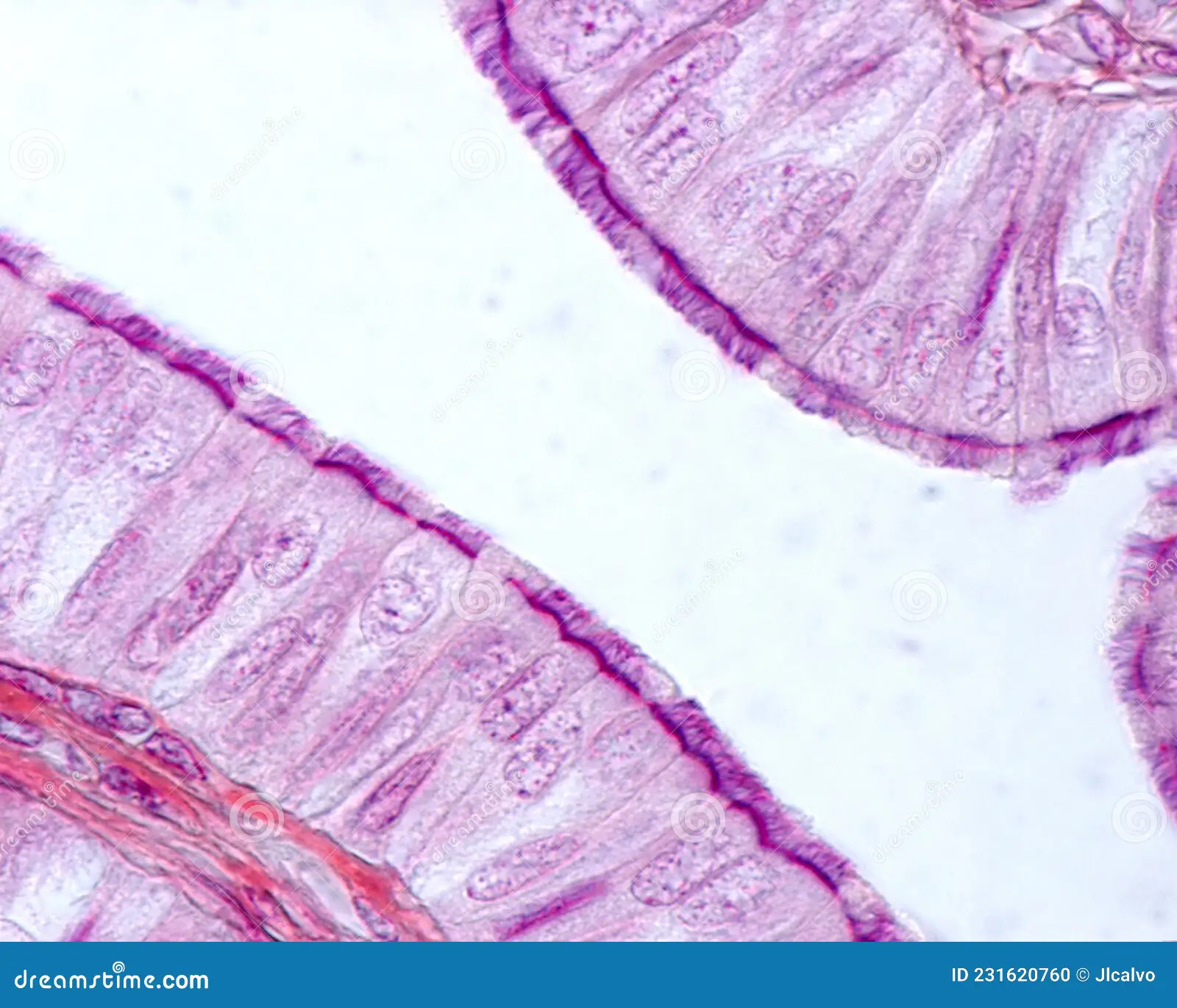 <p>this type of epithelium is composed of simple columnar epithelial cells with cilia on their apical surfaces </p>