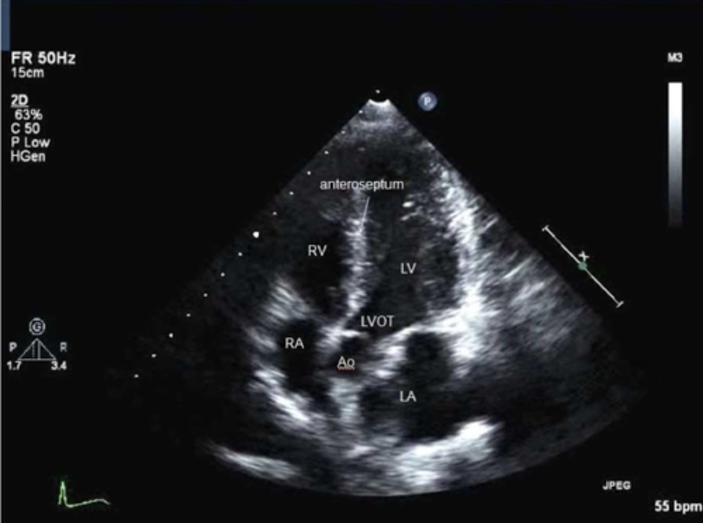 <p>A5 is used to visualize ____, ____, and _____</p>