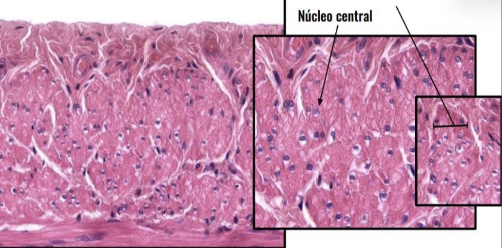 <p>Tejido Muscular Liso</p>