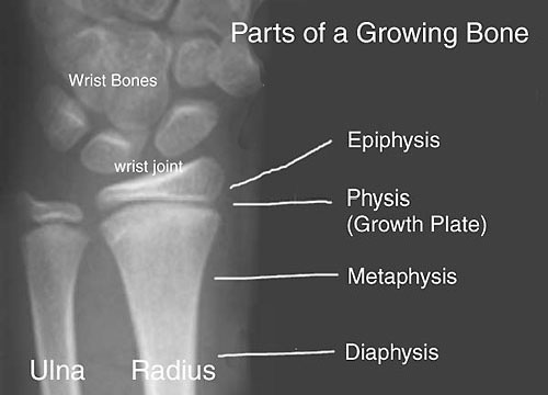 <p>What is the physis in pediatric bones?</p>