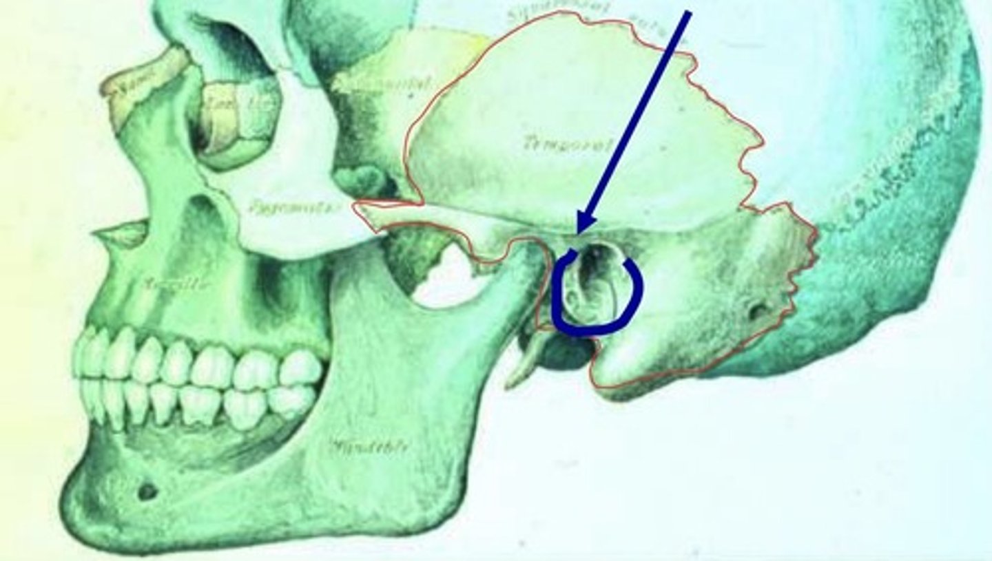 <p>-related to the middle ear or ear drum</p><p>-cartilaginous portion of ear canal is the outer 1/3; the bony portion is the inner 2/3</p><p>-provides rigid superstructure to canal (keeps canal open)</p>