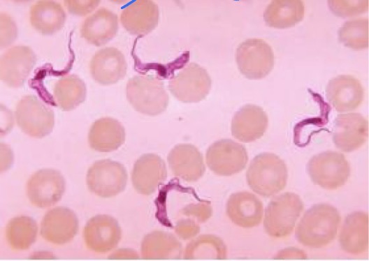 <p>A- what is the method of examination used here </p><p>B-identify the used technique</p><p>C- how to use it</p><p>D- what is the organism</p><p>E- <strong>what is the stain</strong></p><p></p>