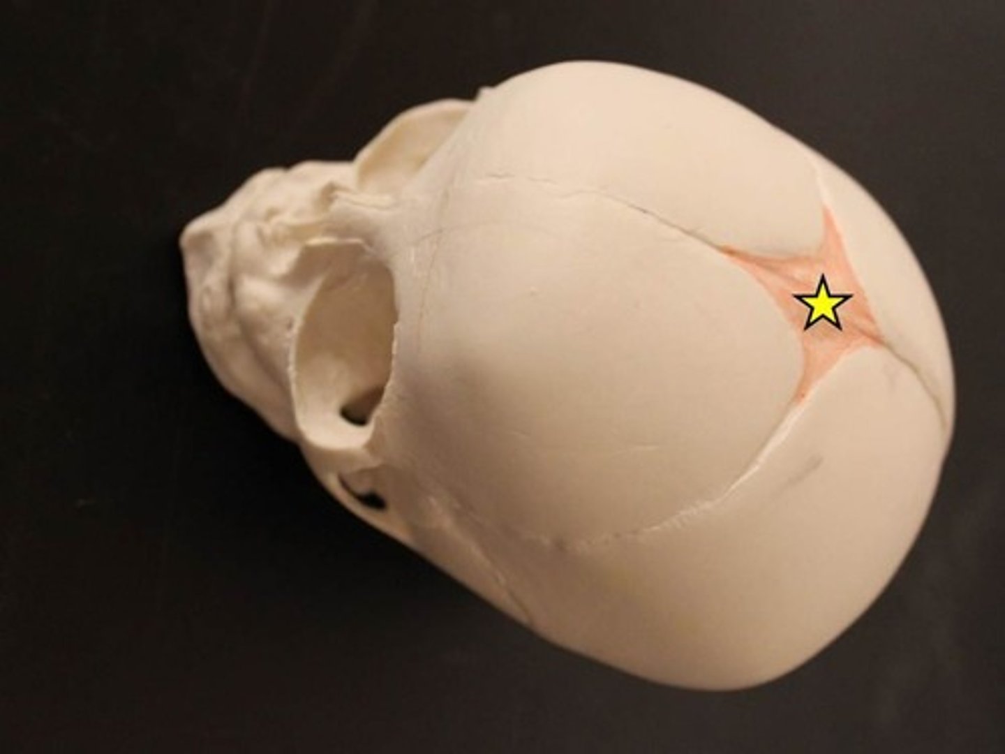 <p>name this bony landmark of the fontanels</p>