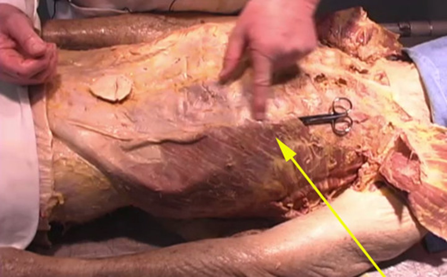 <p>This is the:</p><p>pectoralis major</p><p>pectoralis minor</p><p>external oblique</p><p>internal oblique</p>