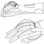 <ul><li><p>utilizes tactile input (elastic bandages) to facilitate and/or inhibit appropriate muscle group</p></li></ul><p></p>