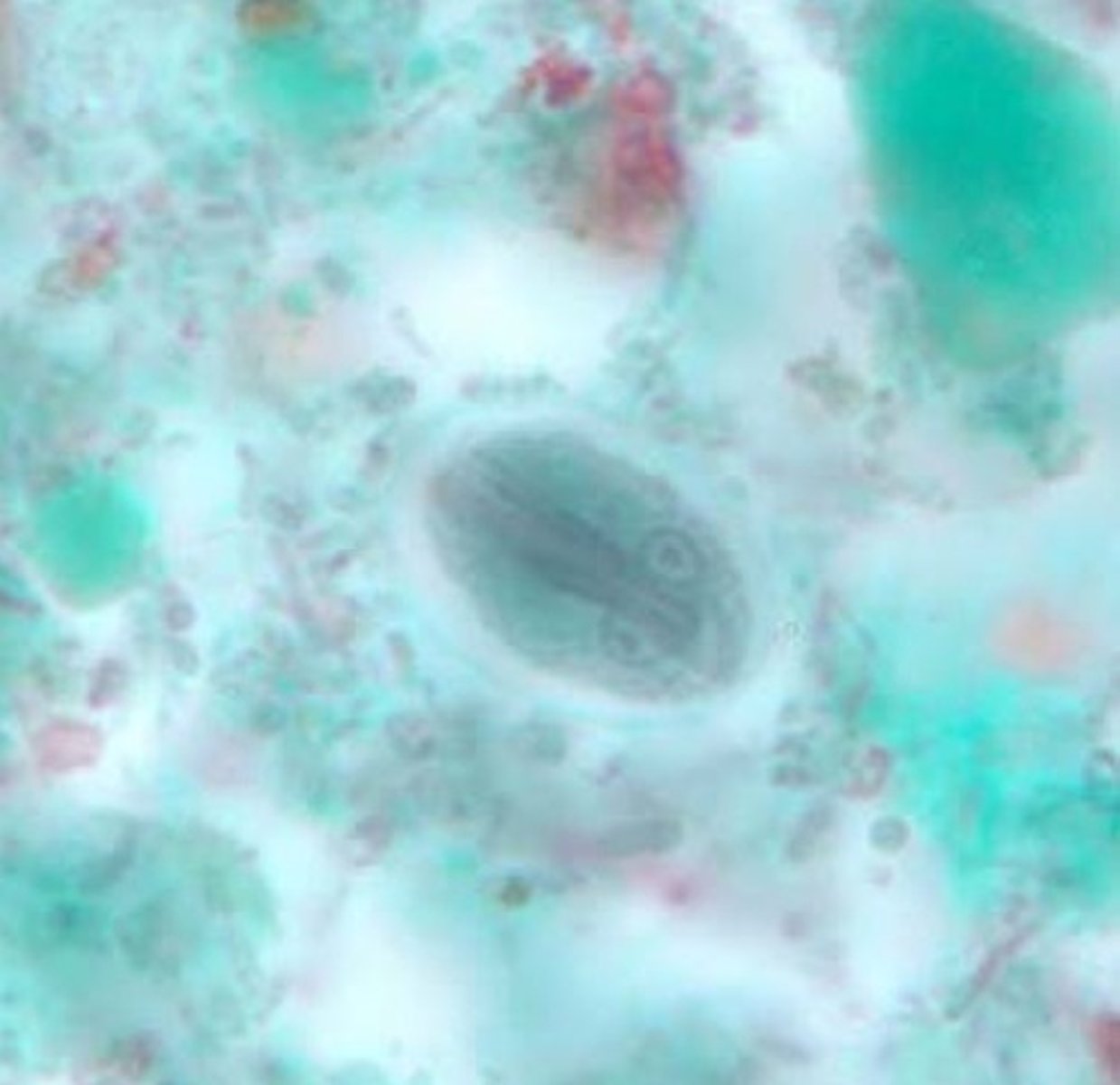 <p>c. Giardia lamblia</p>