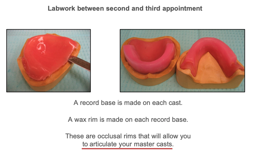 <p>Articulate your master casts</p>