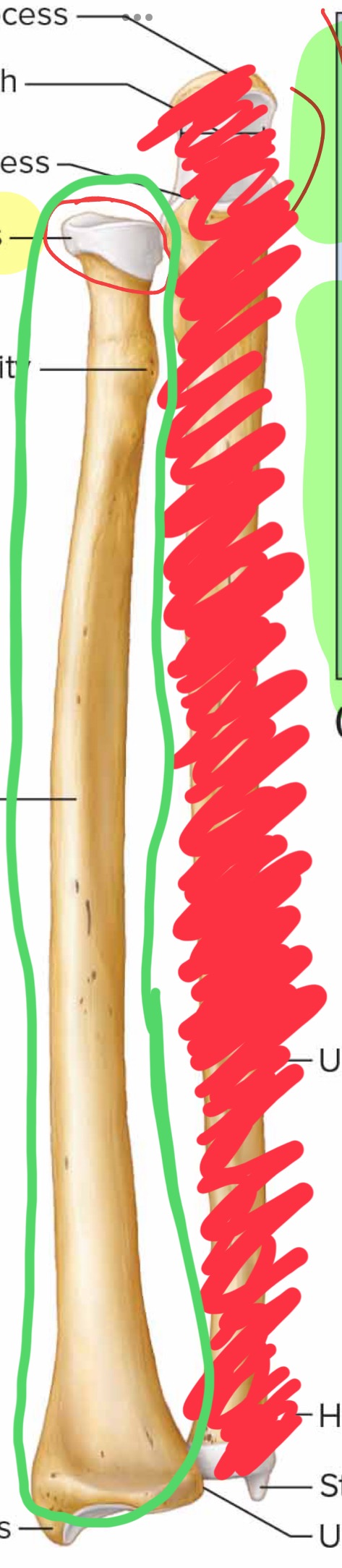 <p>What bone is this?</p>