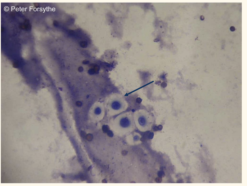 <p>What are these (aspirate from a nodule in a cat)?</p>