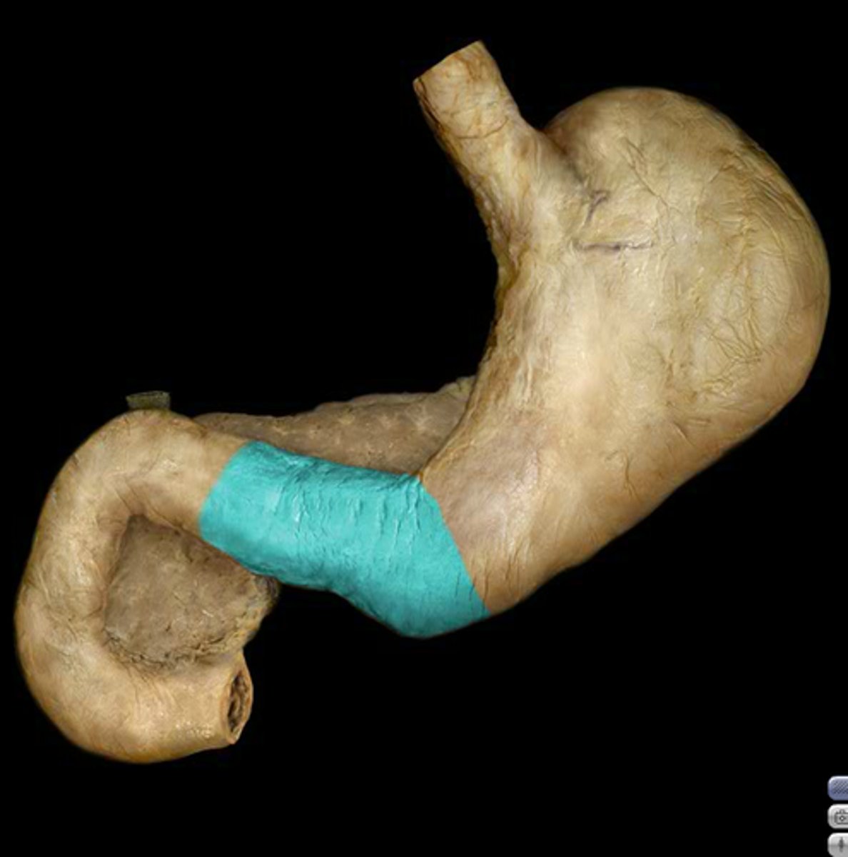 <p>Name the structure of Stomach</p>