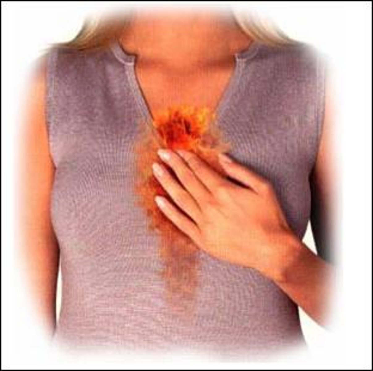 <p>B</p><p>Pyrosis, or heartburn, is caused by esophageal reflux during pregnancy. The other options are not correct</p>