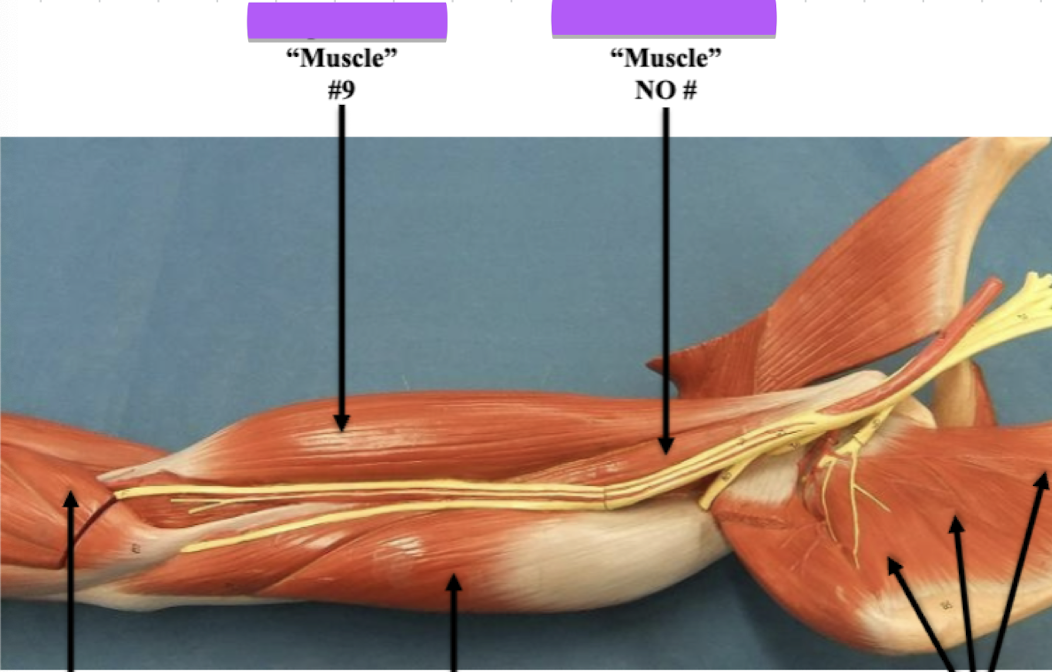 <p>Label muscle no # </p>