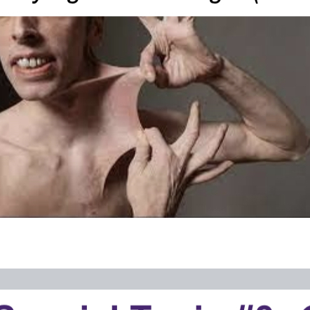 <p>What is ehlers danlos syndrome </p>