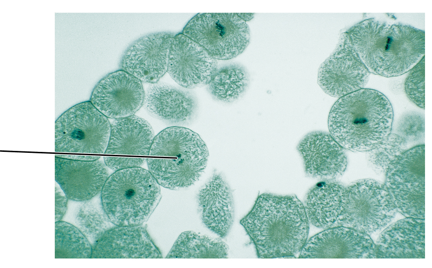 <p>What stage of mitosis is shown by this cell?</p><p>(Cross section of whitefish blastula).</p>