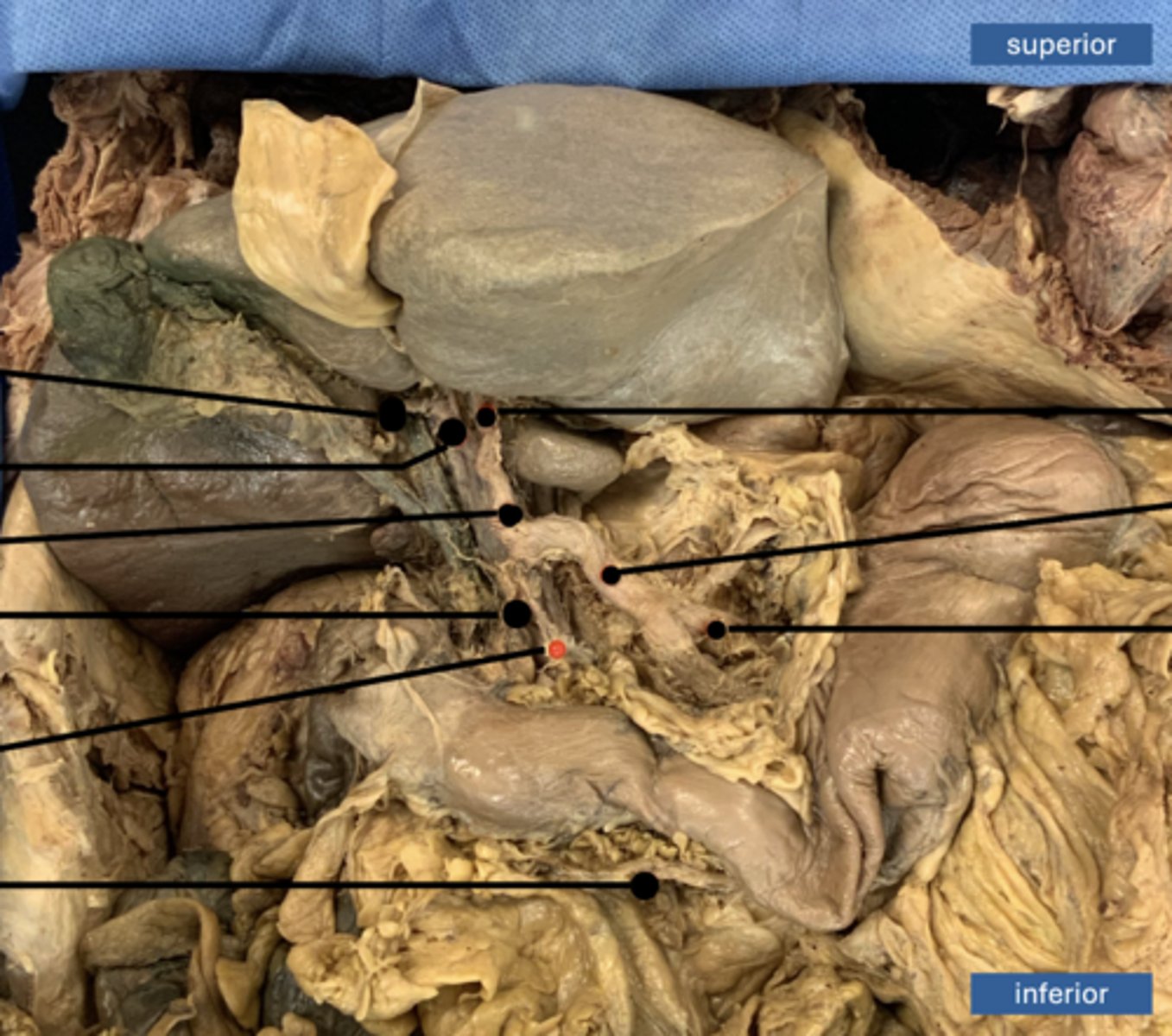 <p>artery</p>