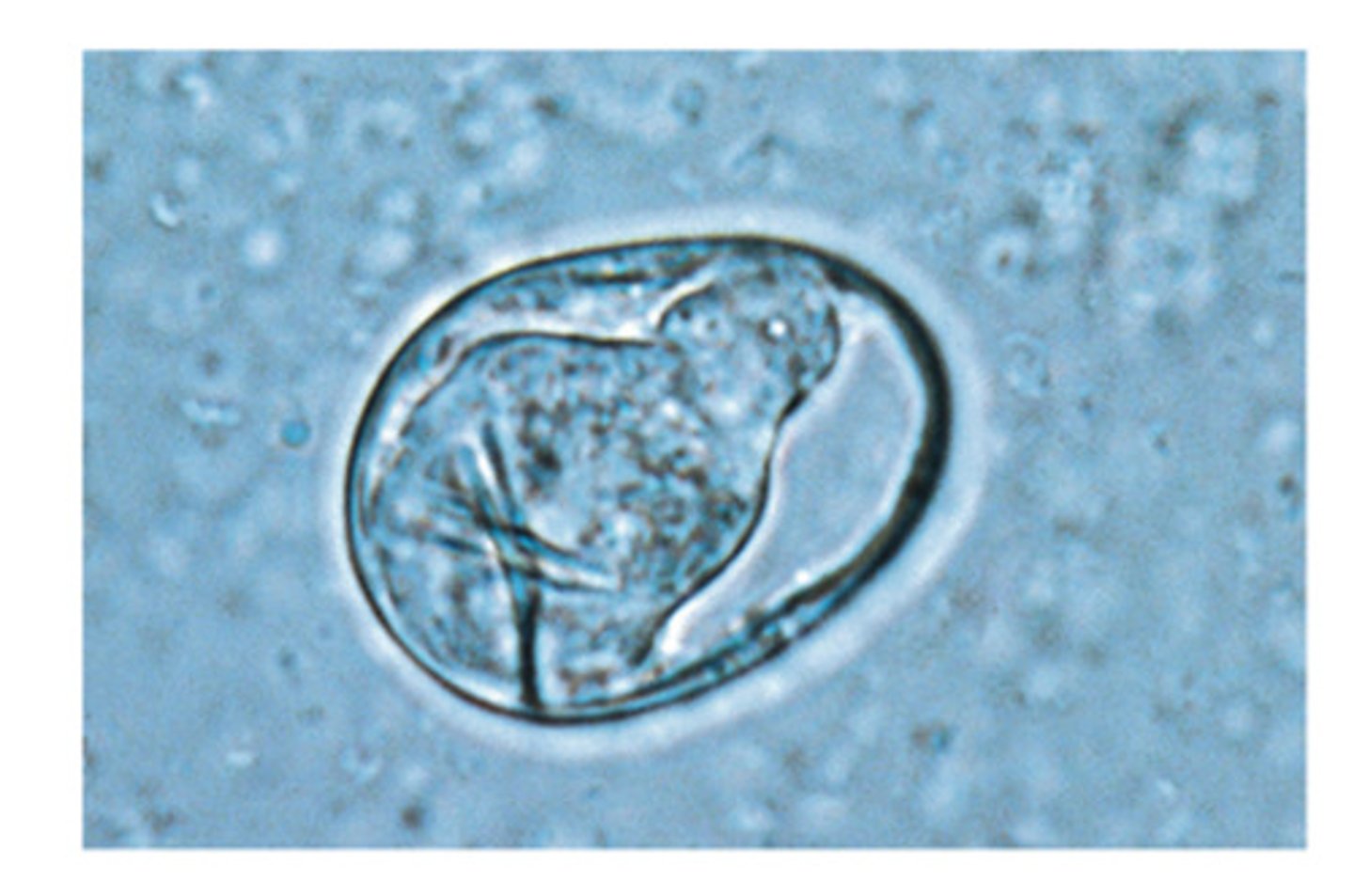 <p>The ova of this tapeworm lack a striated embrophore but has a single onchosphere with 3 pairs of hooks. This ovum belongs to</p>