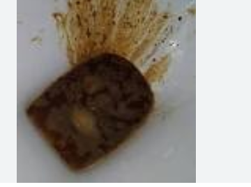 <p><span style="font-family: Droid Sans Mono, monospace">DIARRHEA</span></p>