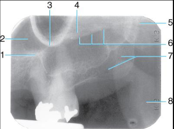 <p>Label the structures 1-8 of the Maxillary molar area </p>